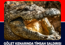 Florida’da Timsah Saldırısı
